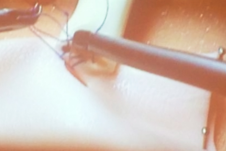 Endoscopic practicing anastomosis using the kit