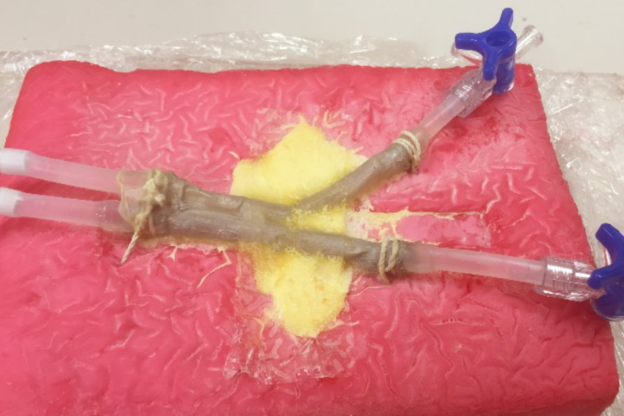 Exfoliation practice model of vascular sheath with 3-layer structural membrane bifurcated blood vessels 10 mm in dia.