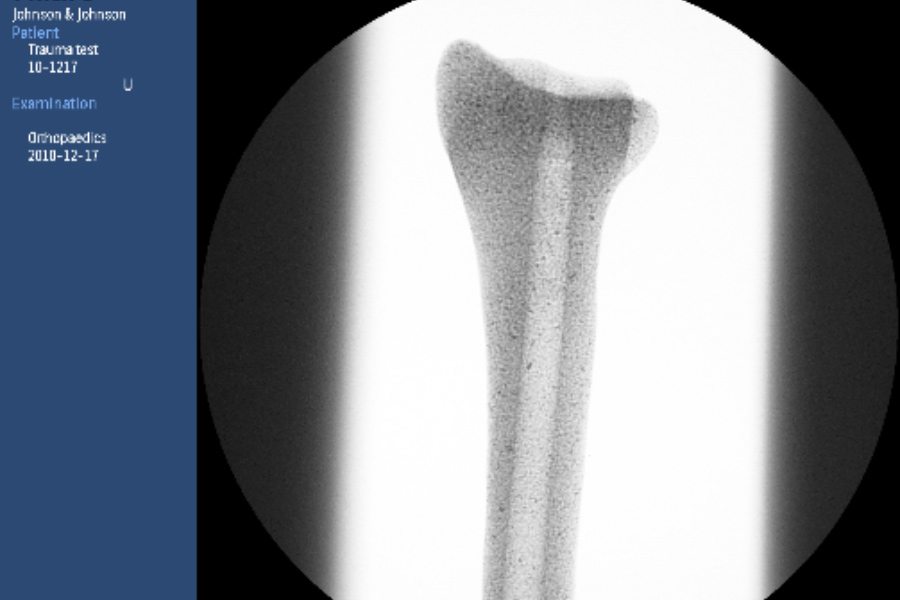 Wetlab bone model appears in X-ray images