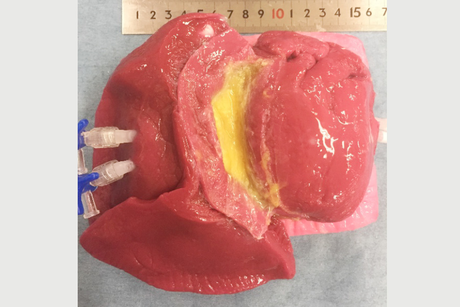 Hilar model has arteries, veins, bronchi, lymph nodes and membranes in the fat model