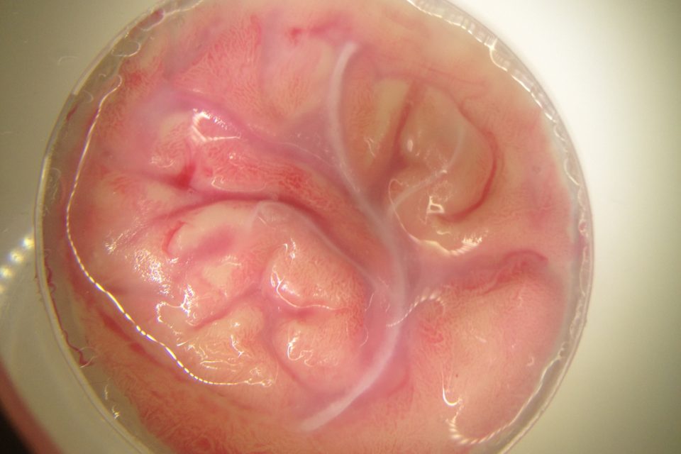 Brain surface petri dish (blood vessel base)