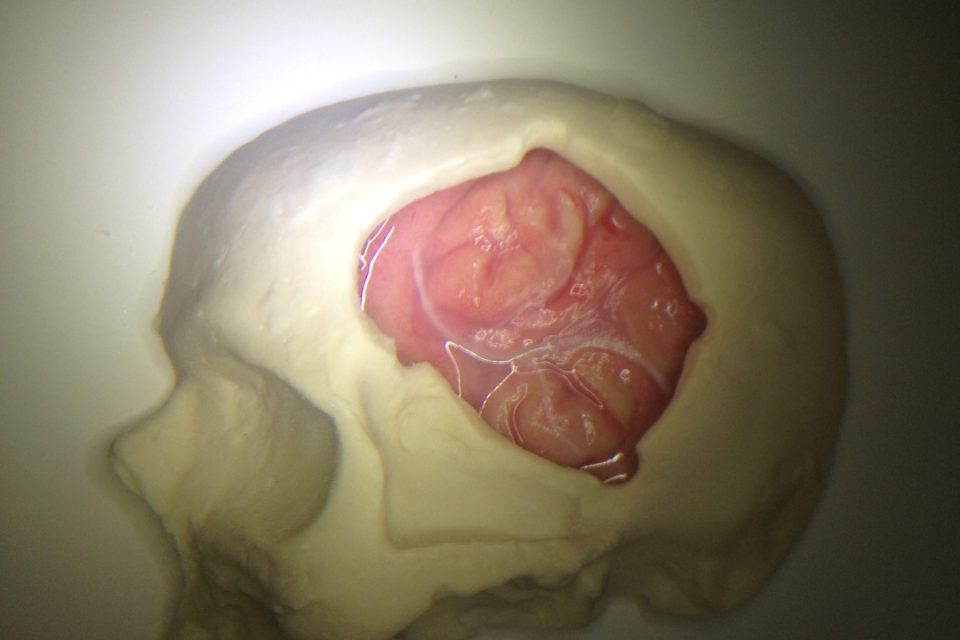 Brain surface petri dish (blood vessel base) in Horizontal bone base for microscope